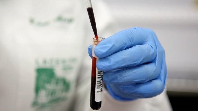 São Pedro do Piauí se destaca em quantidade de realização de testes de covid-19