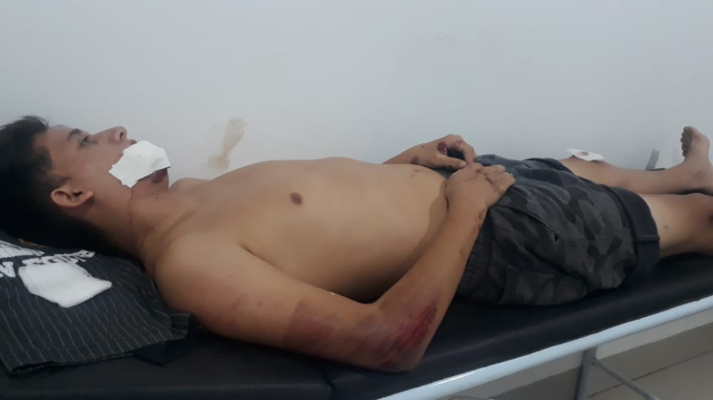 Jovem sofre acidente de moto em Piripiri