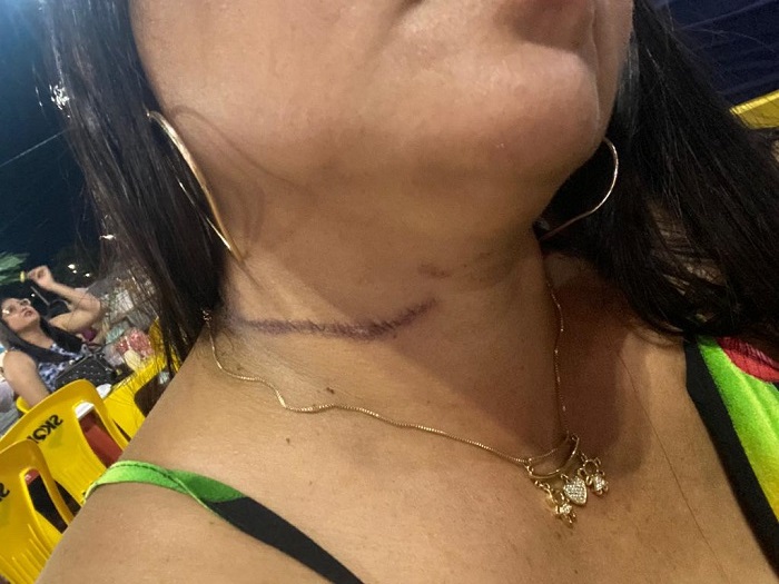 vítima da agressão (Imagem: Reprodução)