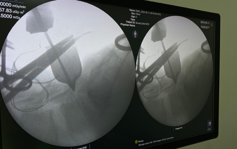 Hospital Justino Luz em Picos realiza primeira cirurgia de coluna por vídeo
