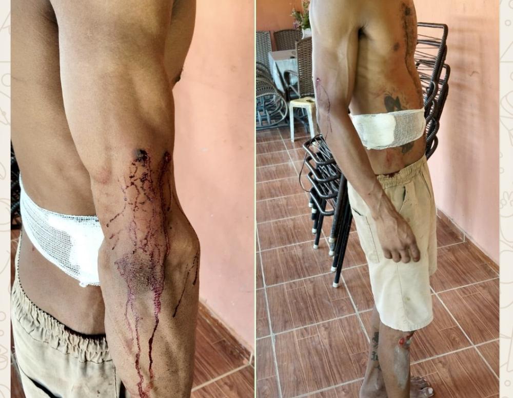 Homem é baleado durante tentativa de homicídio próximo a uma escola em Regeneração