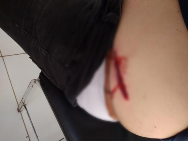 Teresina | Servidor público de 27 anos é baleado durante assalto dentro de UBS da zona sul