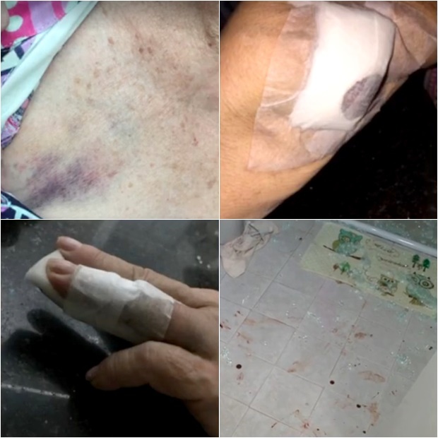 Idosa de 82 anos é espancada e ameaçada de estupro na zona leste de Teresina